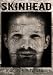 Skinhead