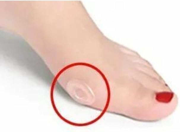 Bunion 6-Piece Toe Sole Callus Tape Pain Relief Perforated Silicone Pad Shoe Anti-Shooting