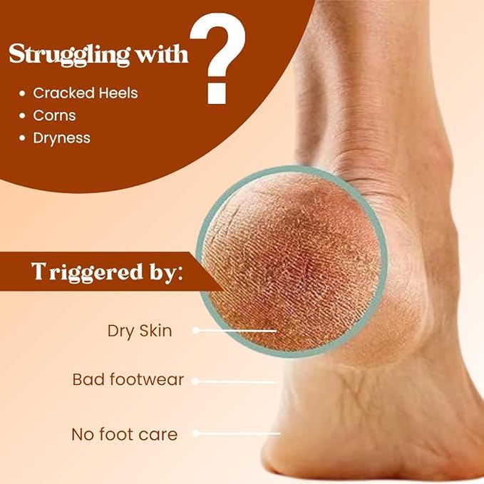 Image of Pokonut Foot Care Cream (Pack of 2)
