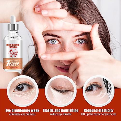 Milia Remover, Milia Spot Serum for Face Milia Spot Removal Helps to Ruduce Milia, Dark Circles Under Eye for Women & Men - Image 2