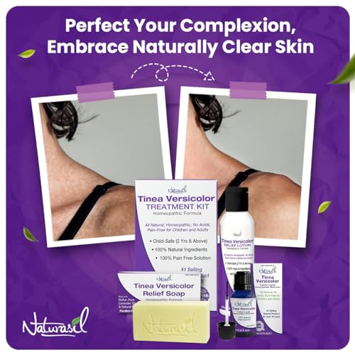 Image of Naturasil Tinea Versicolor Treatment Kit - Max-Strength Antifungal Relief for Skin Discoloration, Sun Spots & Itch | Child & Adult Safe Sulfur Lotion (4oz) + 1 Relief Soap (4oz)
