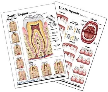 Blue Tree Publishing Tooth Repair Poster, Chart Laminated card, A4
