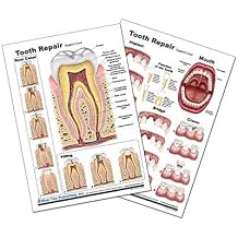 Blue Tree Publishing Tooth Repair Poster, Chart Laminated card, A4
