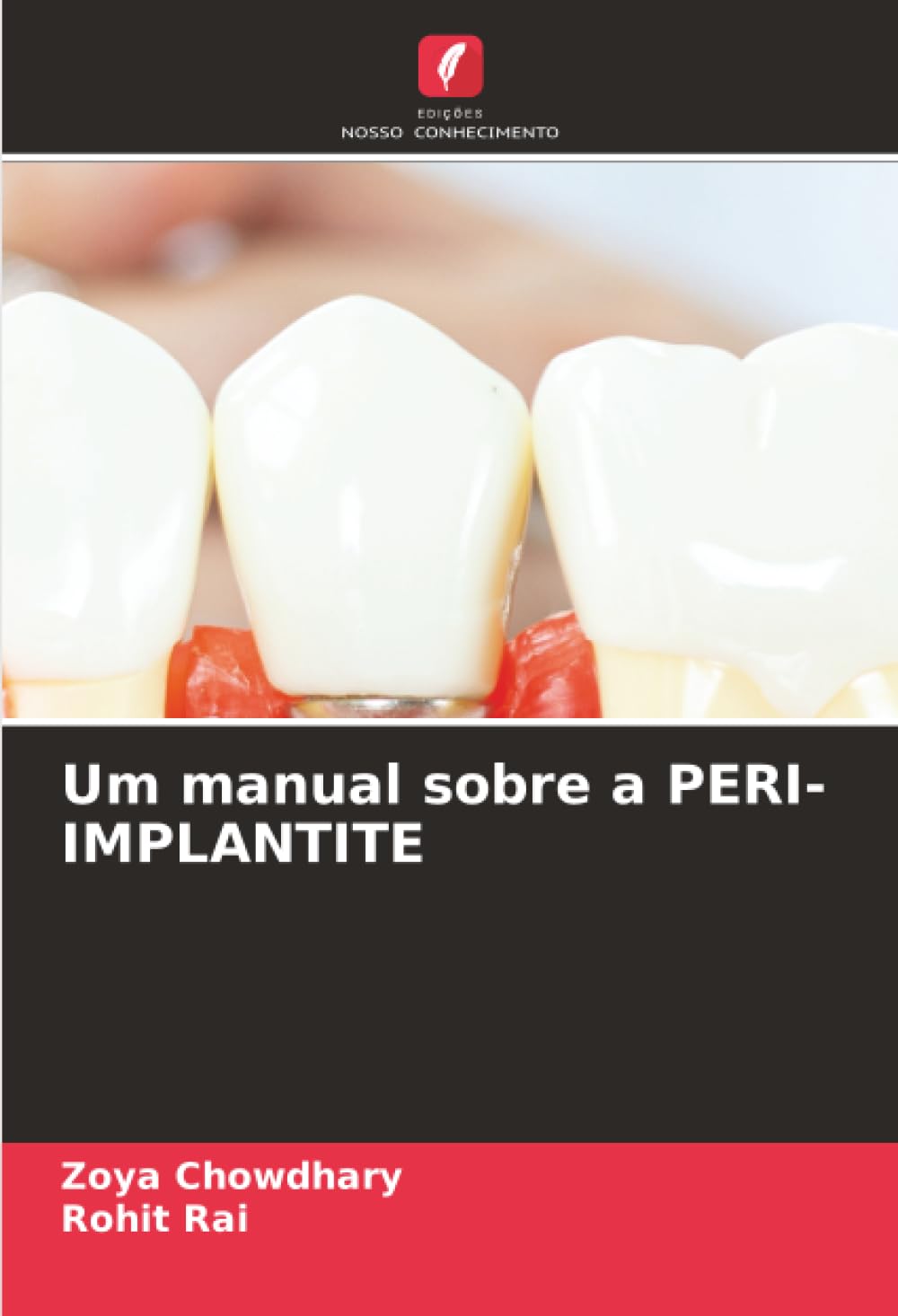 Um manual sobre a PERI-IMPLANTITE