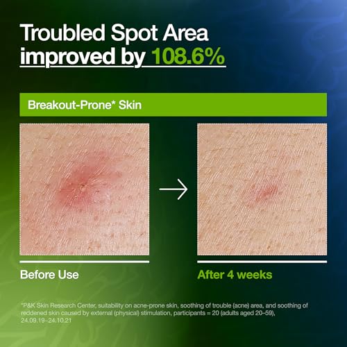 Anua Azelaic Acid 10 Hyaluron Serum, Kpop Demon Hunters, 50ml – Ansicht 5