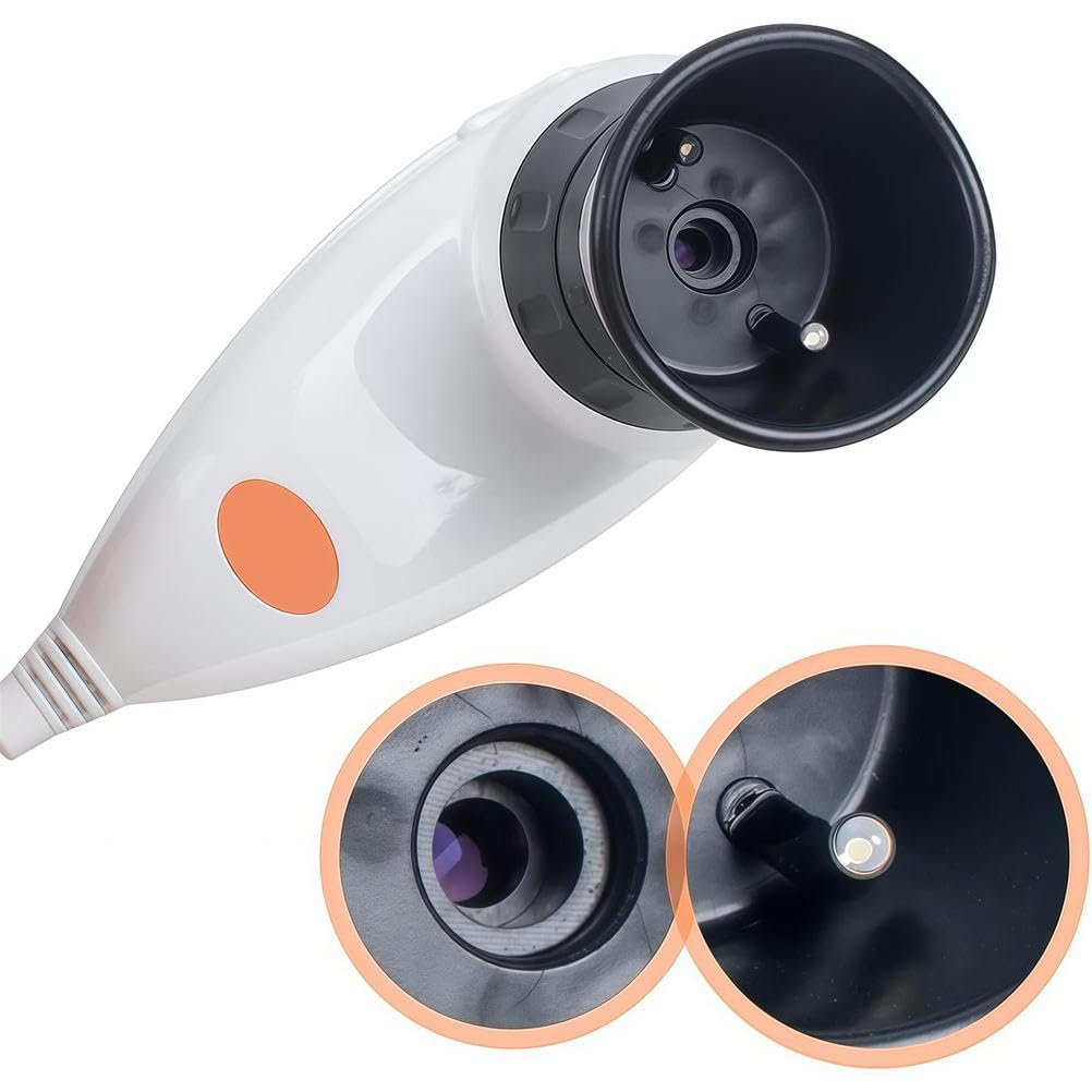 Cámara USB de análisis de iris con software profesional para un examen detallado de los ojos