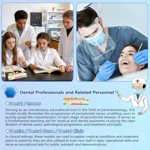 Image of Dental Caries Progression Model,6-Stage Tooth Decay Classification Model for Dental Education,Dental Training,Demonstrations,Oral Care Educatio