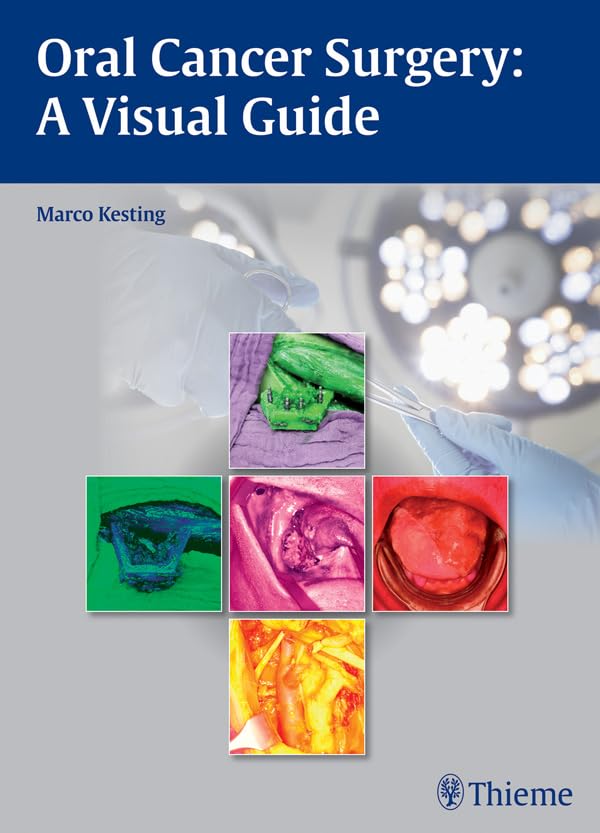 Oral Cancer Surgery: A Visual Guide (English Edition)