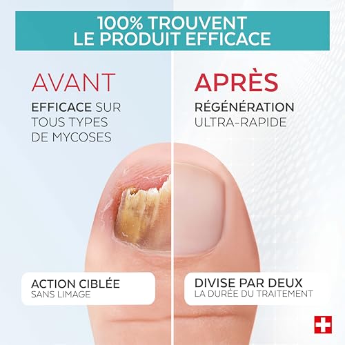 PODERM - LOT MYCOSE ONGLE SEVÈRE 2 PRODUITS | 2 Best Sellers | Traitement complet spécial Mycose difficile à traiter | Soin professionnel pied/main | Facile & rapide | Swiss Made – Image 4