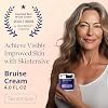 Crema para moretones SKINTENSIVE con árnica para piel delgada – Crema con vitamina K para moretones y decoloración de la piel, crema humectante de árnica para adultos mayores, fórmula no grasa, 4 oz, renovación celular de la piel, 4 onzas (paquete de 1) 6