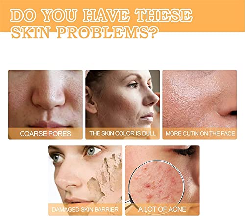 Glycolic Acid 7% Toning Resurfacing Solution, The Ordinary-Glycolic Acid 7% Toning Resurfacing Solution,Ordinary Acido Glicolico For Blemishes And Acne, Facial Exfoliation Astringe Pores-100Ml (1Pcs) #TOP2