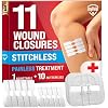Emergency Wound Closure Strips - 11pk - 2 Types Easy to Use Butterfly Bandages - Stitchless & Painless Laceration Closure Kit