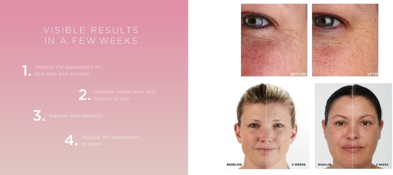 Red Light Therapy for Face LED Face Mask for Eyes, Neck & Skin | Infrared Therapy Mask for Anti-Aging, Wrinkles, Skin Rejuvenation (HSA/FSA Eligible*)