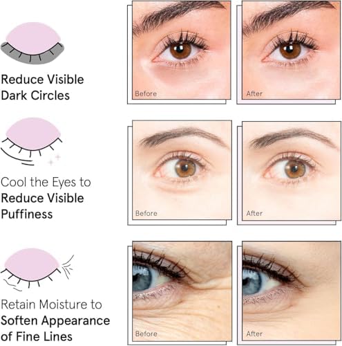 grace & stella Under Eye Mask - Birthday Gifts for Women, Gifts for Mom, Under Eye Patches to Reduce Dark Circles, Puffy Eyes, Eye Bags, Wrinkles, Travel Size Toiletries, Vegan (24 Pairs, Gold) - View 4