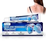 Verruche Rimozione, Crema Occhio di Pernice, Gel Wart Remover 20g, Gentile Crema per Eliminare Fibromi Penduli, Sicuro Verruche Rimozione per Calli Duroni Talpa, Cerotti Occhio di Pernice