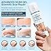 Mitgary Advanced Scar Gel, Silicone Scar Gel, Treats Old and New Scars, Reduces the Appearance of Scars from, Body, Face, Stretch Marks, Surgical Scar, Keloids, Acne, Burns and More, 50g (1.76 Oz)