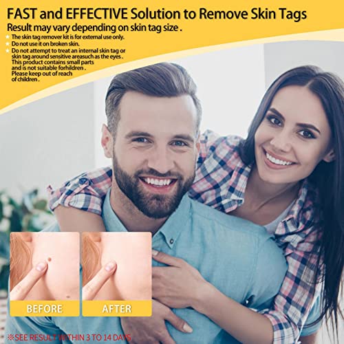 2 Pcs Remoção de Micro Tags | Remoção de Micro Tags 2 em 1 Ajuda a Restaurar a Beleza da Pele - Ferr