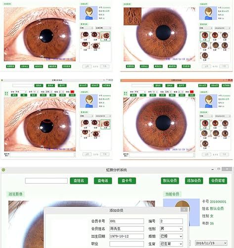 Cámara de iridología portátil y detector de iris de 5.0 MP para centros de salud 5