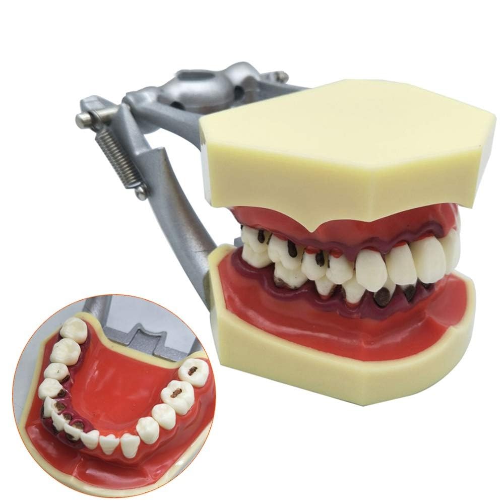 Model przyzębia zębów dentystycznych zęby jamy ustnej dziąsła ząb Typodont Implant Model do nauczania Standard badania