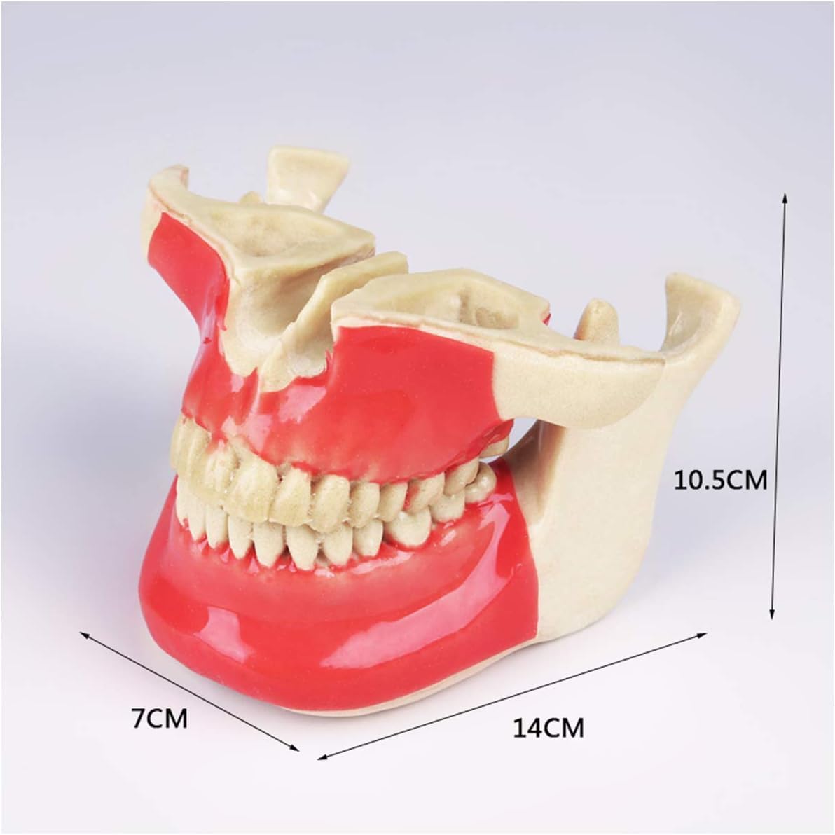 Model zęba Choroba implantu dentystycznego Model zębów Student Materiał żywiczny Zestaw do nauczania ustnego