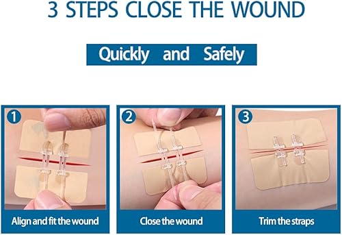 Miniatura 4 de LUBYD Vendas adhesivas de tela flexible y cierres de laceración de emergencia aprobados por la FDA - Repara heridas sin puntadas para heridas de 1