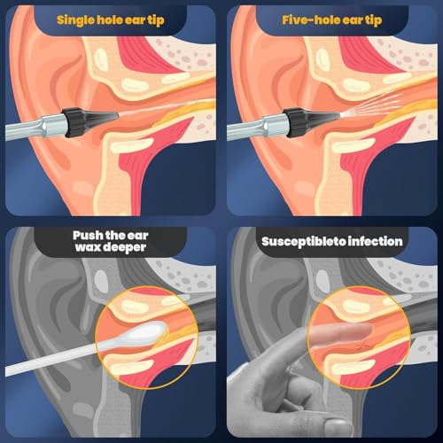 Ear Wax Removal - Electric Ear Cleaner - Ear Irrigation Kit Safe Ear Irrigation Flushing System with 4 Pressure Settings - Effective Ear Wax Removal Tool for Earwax Buildup (Silver)