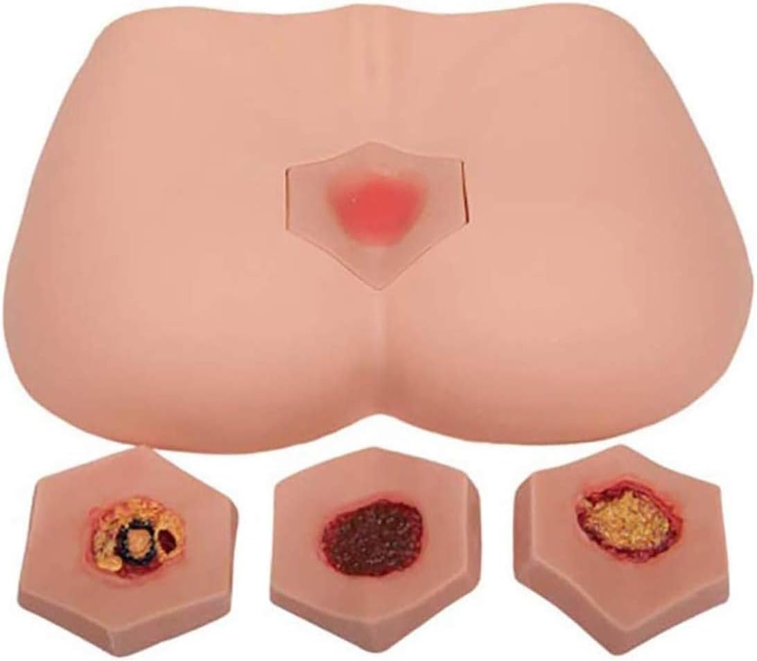 Modello simulatore di piaghe da decubito per allenamento infermieristico, 4 fasi di piaghe da decubito, strumento educativo per pratica medica e cura delle ferite