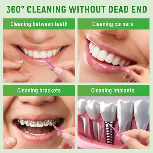 Annauiy 80 Stück Interdentalbürsten,Gemischt Größe 0,6/0,7/0,8/1,0-1,2mm-Für Zahnreinigung Zwischenräume,Zahnspangenreiniger,Zahnzwischenraumbürste,Häusliche Nutzung – Bild 6