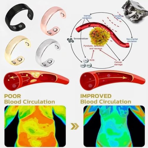 Auvulis Migraine Ring Adjustable Stainless Steel Rings Lymphatic Vitality Magneti Rings Anti Snoring Ring Migraine Relief Jewelry for Women Men3