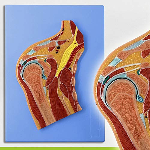 Wellden Medical Anatomical Shoulder Joint Section Model