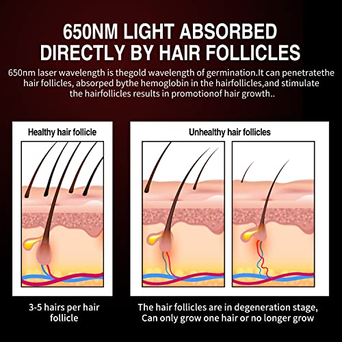 Hair-Regrowth-DevicesLaser-Hair-GenerationLaser-Hair-Helmet-For-Men-And-Women