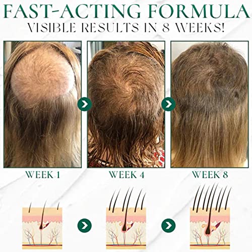 Centella Asiatica Ginger Salt Shampoo Scrub Repair Damaged Hair Anti-Dandruff Oil Control Scrub For Hair Growth Beautiful Hair Healthier Scalp, 200G #TOP2