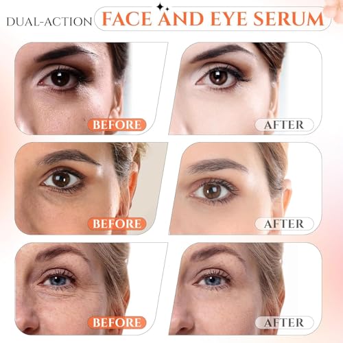 Image of Ragkun 20% Vitamin C Serum, 1 Fl Oz | Retinol, CE Ferulic Acid, Hyaluronic Acid, Dark Spot Remover, Anti Aging & Brightening