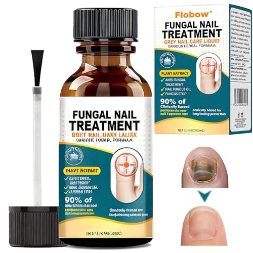 #ColaboraciónPagada<br>30ml Reparadores de Uñas Solución Líquido de Cuidado de Uñas Cuidado Uñas Dañadas con 1 lima de uñas Pueden Calmar y Nutrir Las Uñas Fortalece la estructura de la uña Verde