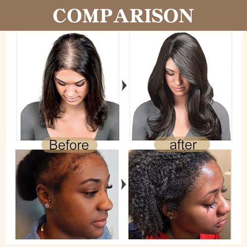 Botanix Batana Batana Oil for Hair Growth - Image 3