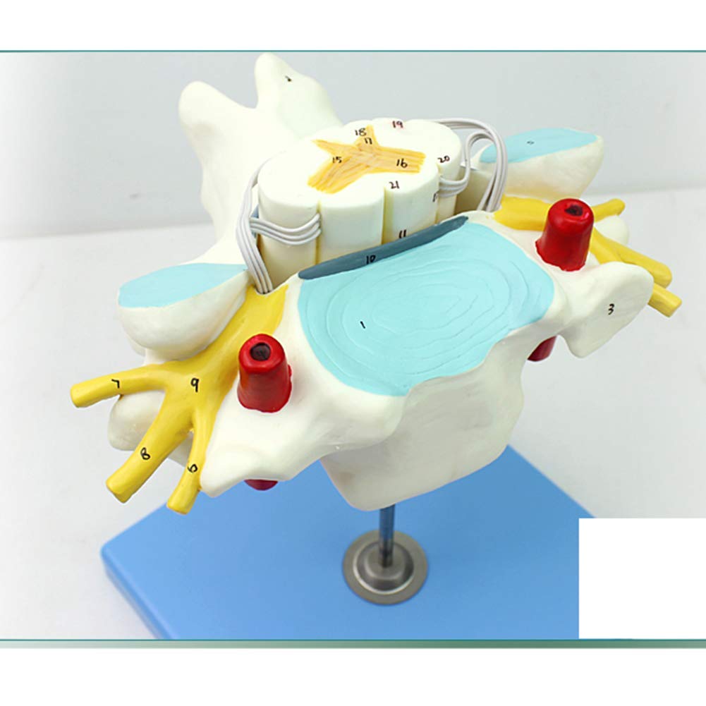 sjdoPulse Cervical Spine Model, Human Spinal Cord And Spinal Nerve Magnified Anatomical Model,for School Study Teaching