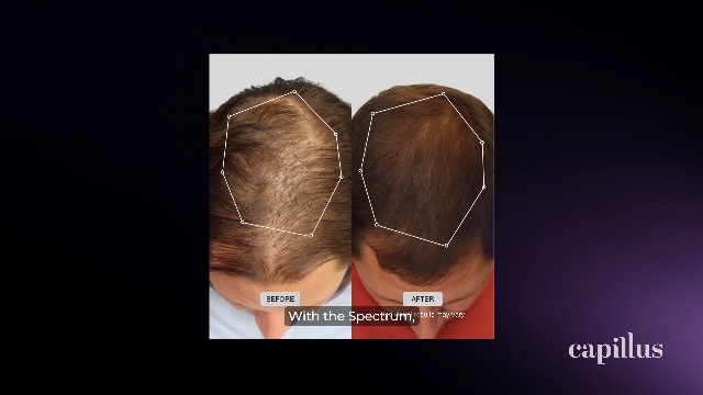 バイオライト光線美容器(Bio Revolution) バイオライト サンライト ソーラー充電式 防災グッズ 停電対策