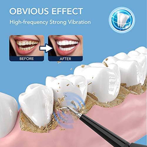 Electric Dental Plaque Calculus Remover Tool Kit - Tooth Scraper Tartar Removal Cleaner - Teeth Cleaning Kit with 2 Replacement Heads, Stains Plaque Remover with LED Display for Adult & Kids - Thumbnail 3