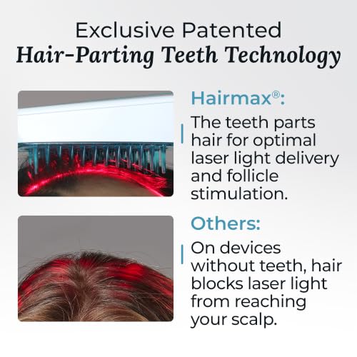 Image of Hairmax Ultima 12 Classic LaserComb- (FDA Cleared) Laser Hair Regrowth Treatment Device for Men & Women - Reverses Thinning Hair Loss - Red Light Therapy to Stimulate Hair Growth - Cordless Design