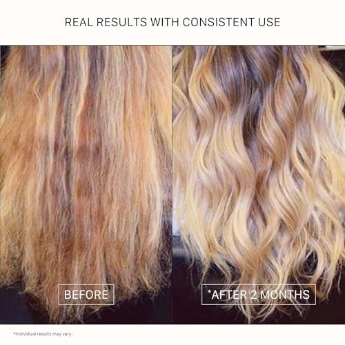 ACTIIV Renew Healing Shampoo Treatment (Unisex) | Improves Hair's Appearance, Promotes Scalp Health, Heals Damaged & Over-Processed Hair, Plant-Based, Color-Safe, Vegan, All Hair Types, 215 mL / 7 oz — view 5