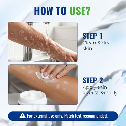 CHARMPOO Antifungal Cream for Jock Itch: 2% Miconazole and Herbal Formula for Itchy Skin Relief Extra Strength - Cures Ringworm Athletes Foot Tinea Versicolor 100g - Thumbnail 4