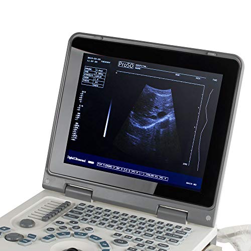 Oysfeel SY-491 Portable 12.1Inch Scanner System thumb #1