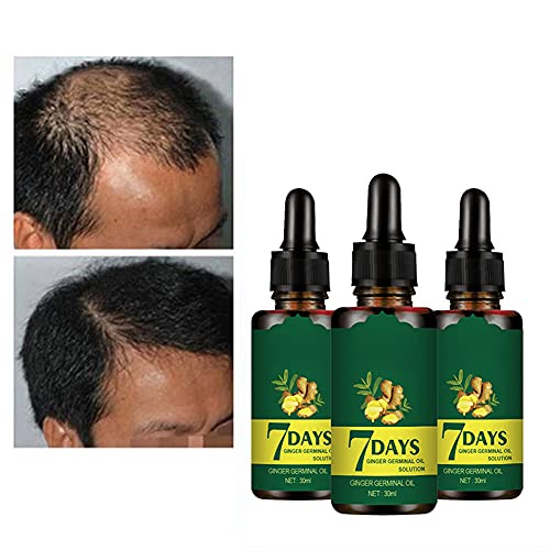 New Upgrade Ginger Hair Growth Oil Hair Growth Essence, Baywell 2020 Hair Loss Liquid Dense Thicken Hair Supports Healthy Hair Growth for Women & Men (3Pcs)
