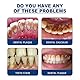 Pemarlis Calculus Free Dissolving Dental Spray, Calculus Dissolving Spray Haushalts-Zahnsteinentferner zur Bekämpfung von Zähnen,Zahnpasta zur intensiven Fleckenentfernung, Frischer Atem (5)