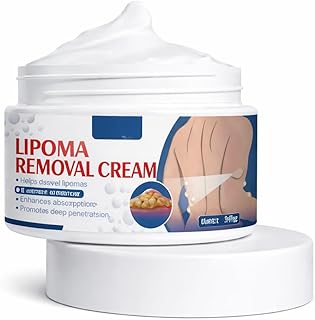 Lipoma Cream Peeling Fat Mass Remove Miracle Ointment Safe Chinese Medicines Beauty Health (1) Price In India
