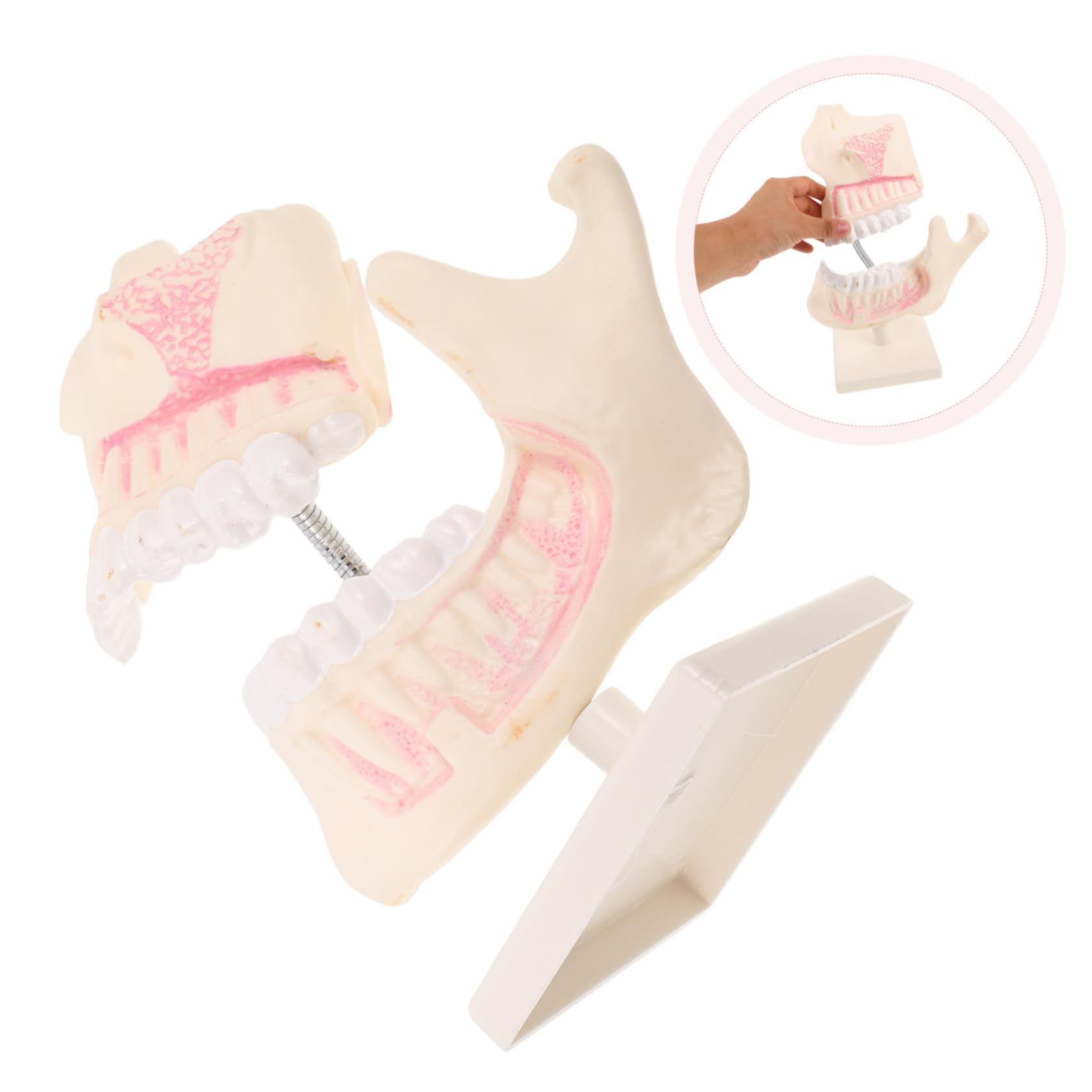 Overdenture Modell Kieferorthopädisches Übungsmodell Zahnersatzreparatur Übungszahnmodell Dekor Skulptur Zahnschnitz Trainingsmodell Zahnschnitz Übungsmodell Kunststoff
