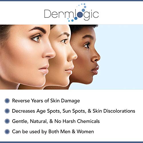 Dark Spot Corrector Cream- Visibly Fades & Repairs Marks From Dark Spots, Sunspots, Age Spots, Acne Scars, Brown Spots & Freckles For Face & Body. Safe For All Skin Types.  #TOP3