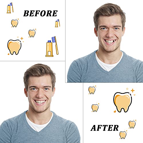 Resin Teeth Veneers Mixed Dental Temporary Teeth Front And Molar Posterior Teeth For Halloween Cosplay Party Makeup Scary Theme Party Costume Filling Fix Missing Broken Tooth (200 Pieces) #TOP5