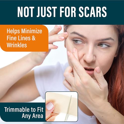 nuvadermis silicone scar tape for surgical scars - 12034 x 1534 roll - medical grade scar tape for wrinkles surgical scars keloid scars and hypertrophic scars - reusable scar sheets roll - 1 pack