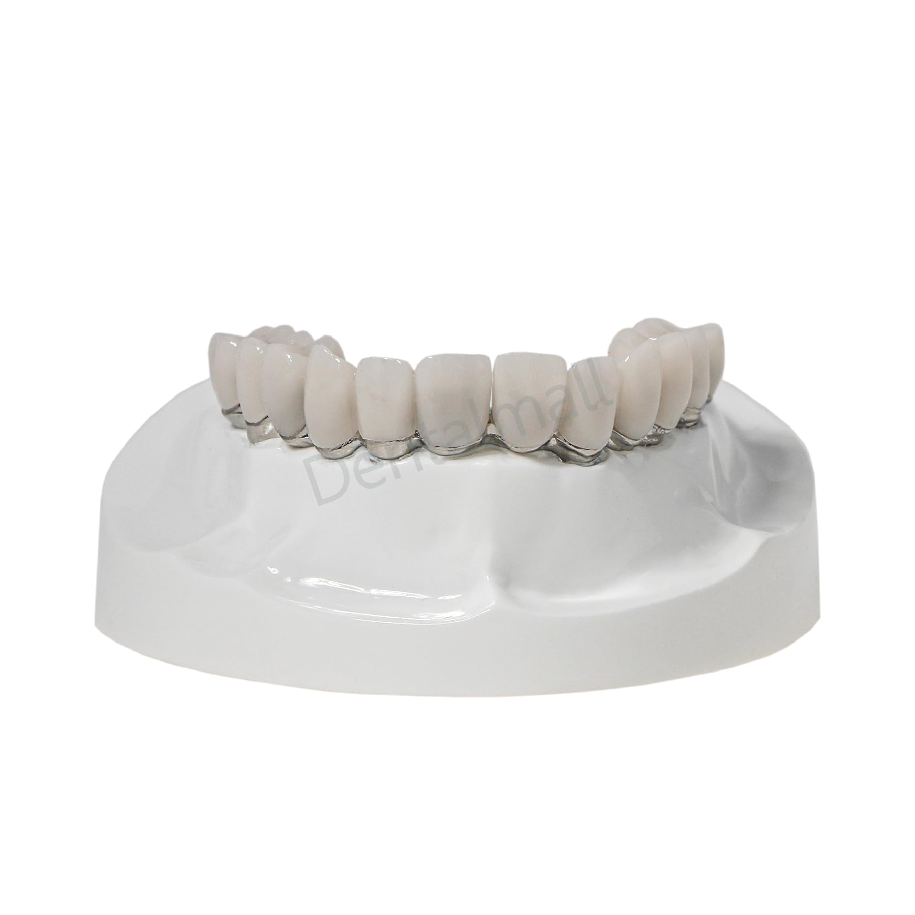 Dental Overdenture Model Upper Jaw Implant Restoration Model 4 Screws M6023